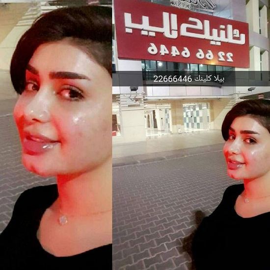 صورة النجمة الكويتية هنادي الكندري بعد خروجها من عيادة التجميل تصدم جمهورها